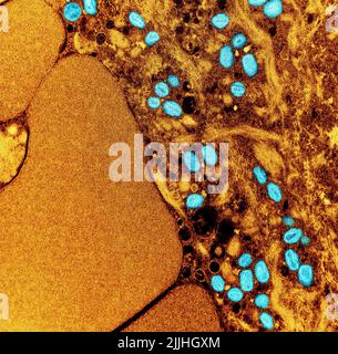 Fort Detrick, États-Unis. 26th juillet 2022. Un micrographe électronique par transmission colorisée des particules du virus de la variole du singe (sarcelle) trouvées dans une cellule infectée (brune) cultivée en laboratoire et capturée à l'installation de recherche intégrée du NIAID a libéré 26 juillet 2022, à fort Detrick, Maryland. Crédit : NIAID/NIAID/Alamy Live News Banque D'Images