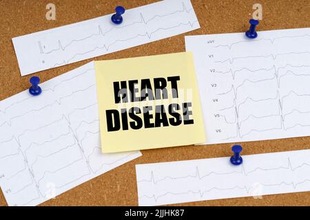 Médecine et concept de santé. Des coupures de cardiogramme et un autocollant portant l'inscription « maladie CARDIAQUE » sont fixés à la carte Banque D'Images