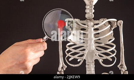 Main avec loupe sur humérus du modèle de squelette humain. Surutilisation de l'épaule, tension, muscles sursollicités, ligaments. Examen d'un bras douloureux avec tache rouge. Photo de haute qualité Banque D'Images