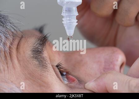 Vue rapprochée d'un homme adulte asiatique senior utilisant une chute oculaire dans l'œil droit après une chirurgie de la catarct. Banque D'Images