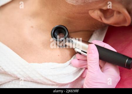 Les mains des femmes examinent la peau d'un homme avec un dermatoscope Banque D'Images