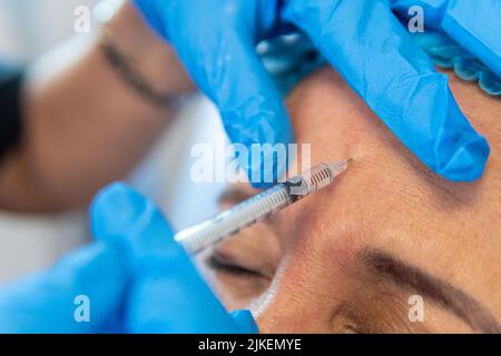 Gros plan des mains d'un médecin avec des gants injectés avec une seringue d'acide hyaluronique sur le front d'un patient. Traitement pour combler les plis Banque D'Images