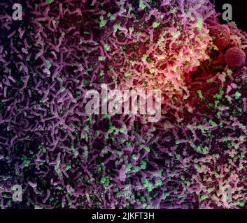Micrographe électronique à balayage colorisé d'une cellule infectée par une souche variante de particules du virus du SRAS-COV-2, isolée d'un échantillon de patient. Image demandée au NIAID Integrated Research Facility (IRF) de fort Detrick, Maryland. Crédit : NIAID Banque D'Images