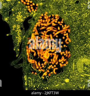 Micrographe électronique de transmission des nucléocapsides du virus Ebola (petits cercles orange) et des particules virales (formes filamenteuses orange plus grandes) dans les cellules rénales infectées du singe vert africain. Image ciblée au Centre de recherche intégré NIAID à fort Detrick, Maryland. Banque D'Images