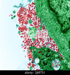 Micrographe électronique par transmission colorisée de cellules BSK cultivées fortement infectées par le virus de la rage. Image achetée et rehaussée de couleurs par le NIAID Integrated Research Facility (IRF) de fort Detrick, Maryland. Crédit : NIAID Banque D'Images