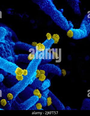 Cette image au microscope électronique à balayage montre le SRAS-COV-2 (particules jaunes rondes) émergeant de la surface d'une cellule cultivée en laboratoire. Le SRAS-COV-2, également connu sous le nom de 2019-nCoV, est le virus responsable de la COVID-19. Image capturée et colorisée aux laboratoires Rocky Mountain à Hamilton, Montana. Crédit : NIAID Banque D'Images