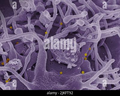 Micrographe électronique à balayage des particules (jaunes) du virus de la fièvre hémorragique de Crimée-Congo (FCMH) qui bourgeonnent de la surface des cellules épithéliales cultivées d'un patient. Banque D'Images