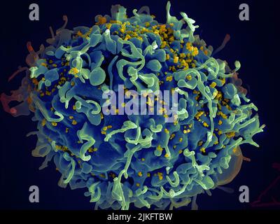 Cette cellule T humaine (bleue) est attaquée par le VIH (jaune), le virus qui cause le sida. Le virus cible les lymphocytes T, qui jouent un rôle essentiel dans la réponse immunitaire de l'organisme contre les envahisseurs comme les bactéries et les virus. Banque D'Images