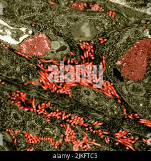 Micrographe électronique à transmission colorisée de l'ovaire d'un primate non humain infecté par le virus Ebola. Des particules filamenteuses caractéristiques du virus Ebola sont présentes entre les cellules (rouge vif). Les corps d'inclusion intracytoplasmiques du virus Ebola formant des treillis cristallins peuvent être observés dans les cellules stromales ovariennes (rouge foncé). Banque D'Images