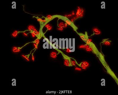 La maladie de pompe est une maladie héréditaire rare caractérisée par la déficience d'une enzyme appelée alpha-glucosidase acide (GAA). L'une des principales caractéristiques de la maladie de pompe est la rupture progressive des communications entre les cellules nerveuses et musculaires. Cette image est d'un muscle de jambe (tibialis antérieur) d'un modèle de souris adulte de la maladie de pompe. Les cellules nerveuses (vertes) et les sites cellulaires de communication neuromusculaire, appelés jonctions neuromusculaires, (rouges) sont marqués par fluorescence pour observer la détérioration continue des jonctions neuromusculaires. Banque D'Images