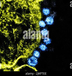 Micrographe électronique à transmission colorisée particules du virus mers (bleu) trouvées près de la périphérie d'une cellule VERO E6 infectée (jaune). Banque D'Images