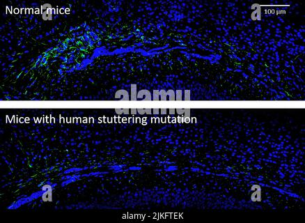 Dans un modèle de souris de stuttering (panneau inférieur), il y a moins d'astrocytes, affichés en vert, par rapport aux contrôles (panneau supérieur) dans le corps callosum, la zone du cerveau qui permet aux hémisphères gauche et droit de communiquer. Banque D'Images