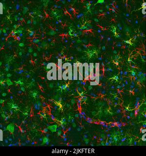 Microscopie d'un échantillon de moelle épinière à partir d'un modèle de neurodégénérescence de souris. Les colorants fluorescents suivants sont utilisés : DAPI est bleu, TDP-43 est vert et GFAP est rouge. Des chercheurs de l'unité de neurodégénérescence développementale de l'Eunice Kennedy Shriver National Institute of Child Health and Human Development (NICHD) utilisent ces modèles pour étudier les événements précoces qui sous-tendent l'apparition et la progression de maladies neurodégénératives, telles que la sclérose latérale amyotrophique et la maladie de Parkinson. Banque D'Images