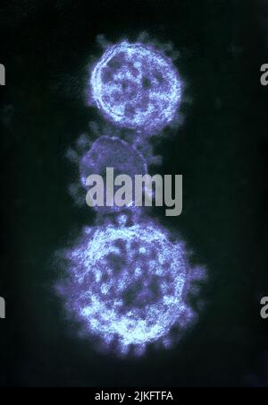 Micrographe électronique à transmission colorisée révélant des particules du coronavirus du syndrome respiratoire du Moyen-Orient qui est apparu en 2012. Banque D'Images