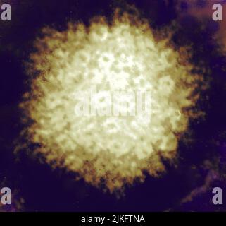 Micrographe électronique semblable au feu du virus de l'herpès simplex. Banque D'Images