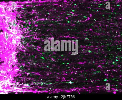 Une étude de souris financée par le NIH est la première à montrer que la stimulation visuelle aide à remandier le système visuel et restaure partiellement la vue. Cette image montre la régénération des axones des cellules ganglionnaires de la rétine de la souris (magenta et vert) s'étendant du site de lésion du nerf optique (gauche). Banque D'Images