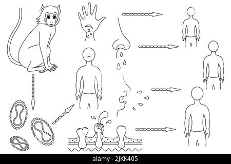 La variole du singe. La voie d'infection et le mécanisme de transmission du virus de la variole aux humains. Esquisse. Singe - virus - homme. Illustration vectorielle Illustration de Vecteur