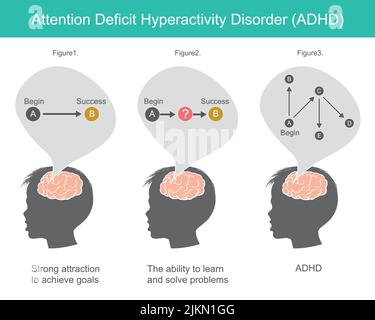 Trouble d'hyperactivité avec déficit de l'attention. Expliquer les façons de penser et de résoudre les problèmes qui sont arrivés au cerveau de l'enfant. Illustration de Vecteur