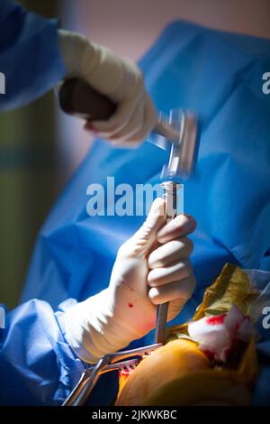 Salle d'opération de chirurgie orthopédique pour l'acromioplastie et la ténodésie des biceps. Banque D'Images