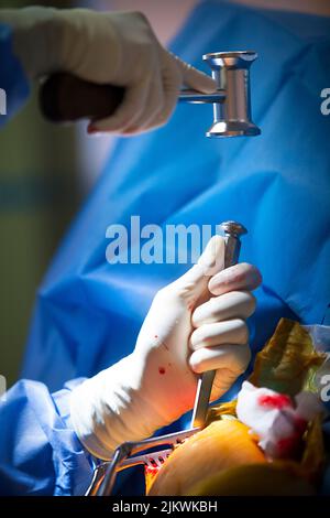 Salle d'opération de chirurgie orthopédique pour l'acromioplastie et la ténodésie des biceps. Banque D'Images