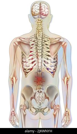 Système osseux : squelette humain avec représentations de la douleur lombaire. Banque D'Images