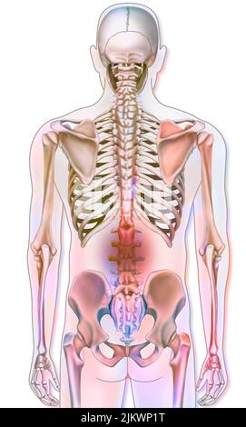 Système osseux : squelette humain avec représentations de la douleur lombaire. Banque D'Images