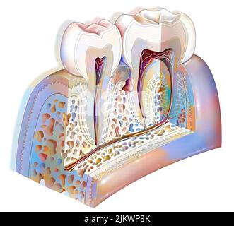 Plaque dentaire: Pathologies principales des dents: Tartre, gingivite. Banque D'Images