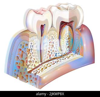 Plaque dentaire: Pathologies principales des dents: Tartre, gingivite. Banque D'Images