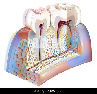 Plaque dentaire: Pathologies principales des dents: Tartre, gingivite. Banque D'Images