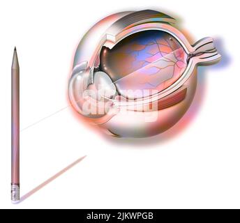 Anatomie d'un œil et de la vision, réflexion au crayon sur la rétine. Banque D'Images