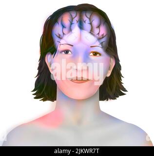 Cerveau (hémisphères cérébral droit et gauche) dans le visage d'une femme. Banque D'Images