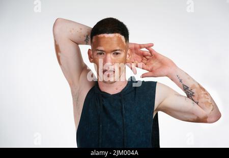 Pourquoi s'intégrer quand vous êtes né pour se démarquer. Portrait d'un beau jeune homme avec le vitiligo posé en studio. Banque D'Images