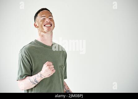 Choisissez d'être optimiste - il se sent juste mieux. Studio tourné d'un jeune homme avec le vitiligo applaudi sur fond blanc. Banque D'Images