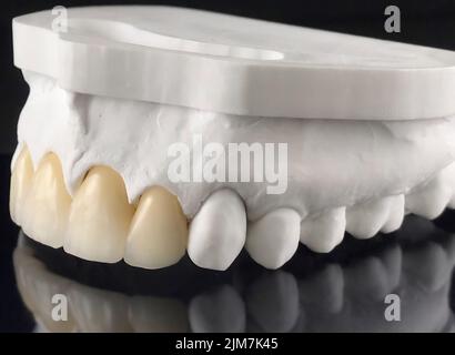 Technicien dentaire travaillant dans des couronnes en céramique. Plans techniques de prothèse dentaire et modèle sur un laboratoire de prothèse dentaire. Banque D'Images