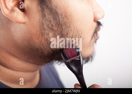 Micronéedling, homme caucasien utilisant le rouleau pour la croissance de la barbe sur fond blanc. Banque D'Images