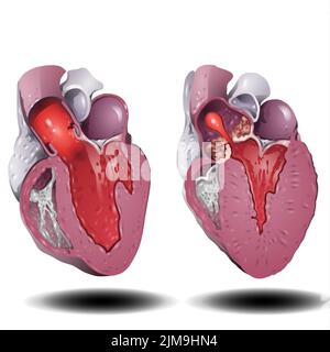 Cœur humain. Organe anatomique musculaire humain pompes organes sanguins, organe interne en coupe avec système circulatoire. Vecteur de symbole de cœur sur fond blanc Banque D'Images