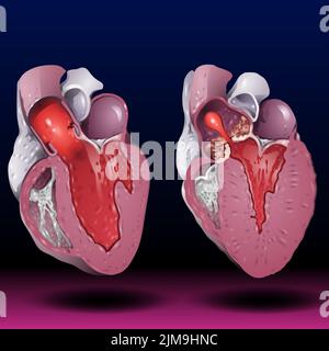 Cœur humain. Organe anatomique musculaire humain pompes organes sanguins, organe interne en coupe avec système circulatoire. Vecteur de symbole de cœur Banque D'Images