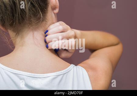 Grand concept d'allergie et les maladies de peau, jeune femme rayures elle-même. Banque D'Images