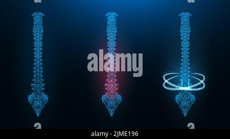 Illustration vectorielle polygonale d'une courbe de contrôle humaine. Image d'une colonne vertébrale saine, malade et en rétablissement. Banque D'Images