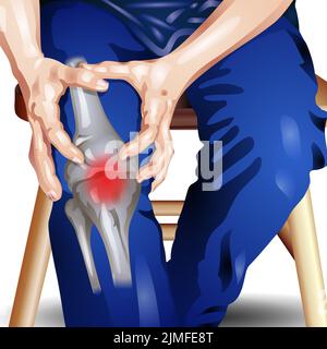 Douleur douloureuse aux articulations du genou et lésion de la jambe comme douleur chronique brûlante inflammation due à une blessure ou à un accident de travail - Illustration vectorielle Banque D'Images