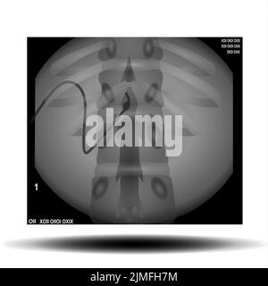 Radiographie du rachis sur fond blanc Banque D'Images