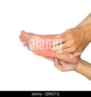 Peau de pied itchy de jeune homme asiatique. Concept de maladies de la peau telles que la gale, l'infection fongique, l'allergie, etc Banque D'Images