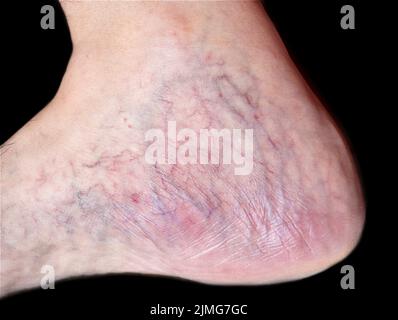 Rides de la peau et veines proéminentes visibles à travers la peau mince du pied de l'asiatique vieux. Banque D'Images