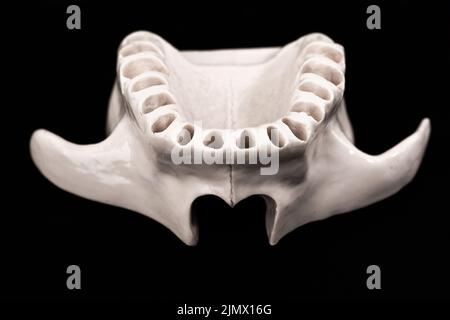 La mâchoire supérieure humaine sans dents modèle d'implant médical isolé sur fond noir. Des dents en bonne santé, des soins dentaires et des soins orthodontiques Banque D'Images