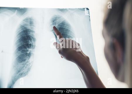 Femme blonde méconnaissable médecin pointant vers une radiographie des poumons du patient. Gros plan. Prise de vue en studio. Espace de copie isolé. Photo de haute qualité Banque D'Images