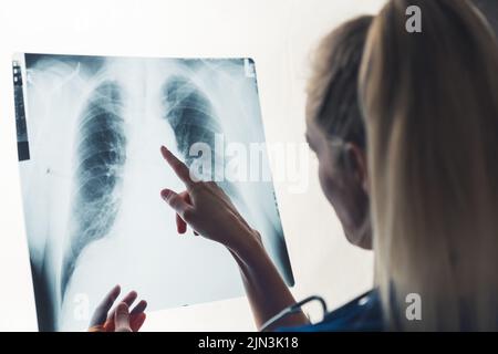 Femme blonde blanche médecin vu de derrière tenant une radiographie des poumons et pointant partageant le diagnostic. Prise de vue en studio. Isolé. Photo de haute qualité Banque D'Images