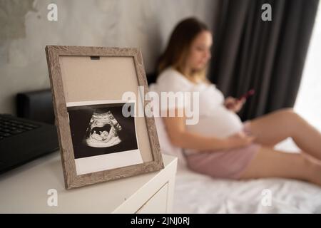 échographie photo du fœtus dans le cadre, femme enceinte au lit sur fond, grossesse et échographie de contrôle concept Banque D'Images