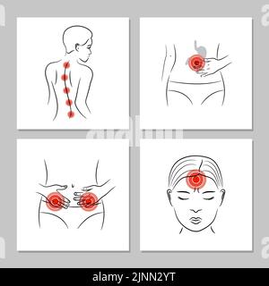 Ensemble de vecteurs de douleur. Affiches médicales avec des douleurs corporelles dans différentes parties. Illustration de Vecteur