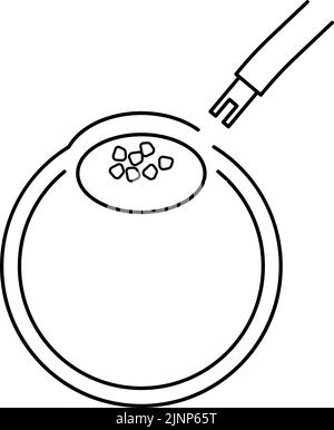 Processus de chirurgie de la cataracte, Illustration (dessin de ligne), sucer le cristallin nuageux Illustration de Vecteur