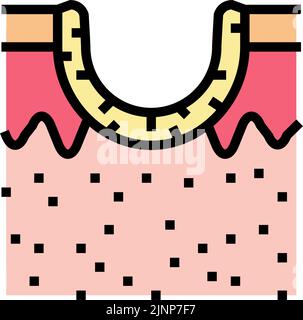 illustration vectorielle de couleur d'icône de cicatrice d'acné de roulement Illustration de Vecteur
